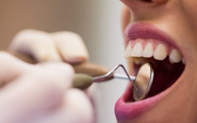 Métaux dans la bouche